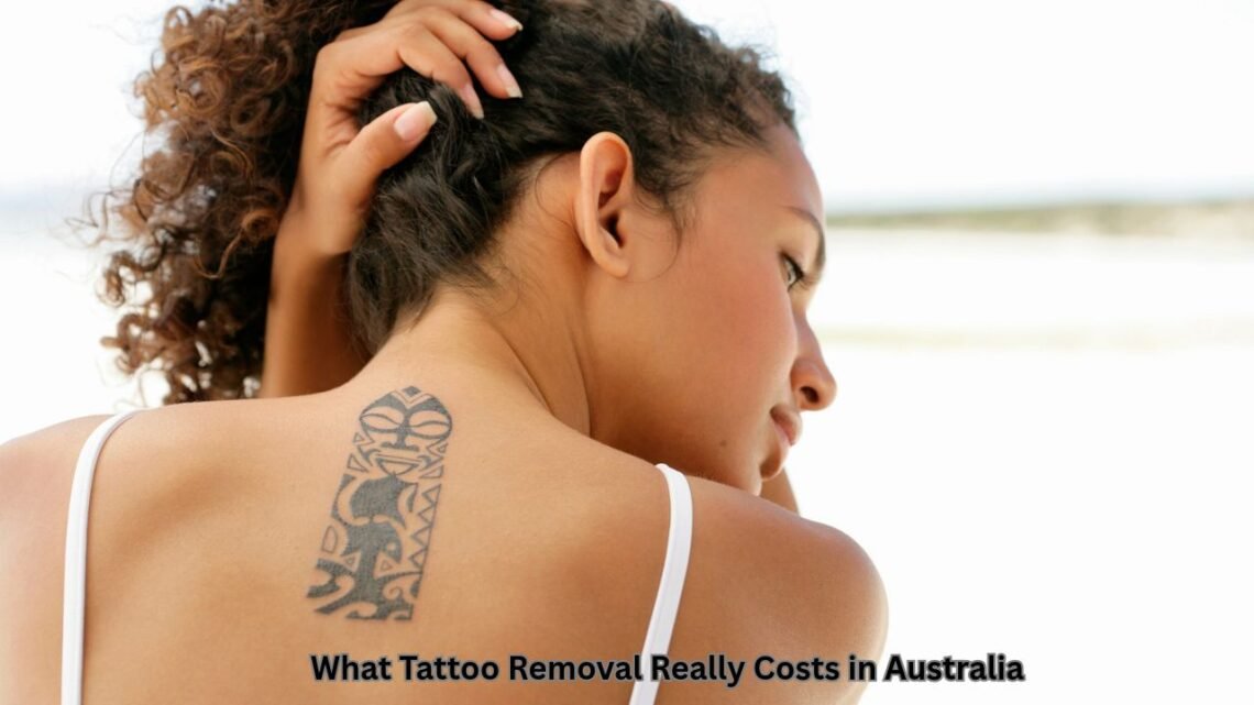 What Tattoo Removal Really Costs in Australia
