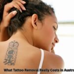 What Tattoo Removal Really Costs in Australia