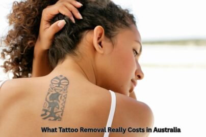 What Tattoo Removal Really Costs in Australia